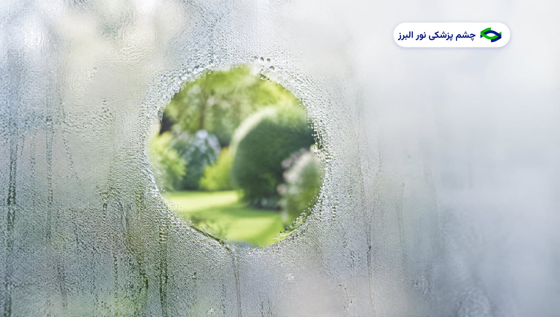 تاری دید بعد از عمل آب مروارید: کدورت کپسول و لیزر YAG